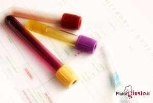 urine-colore-3